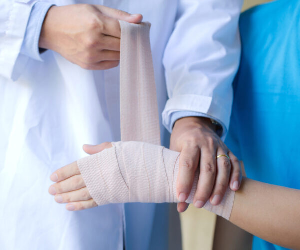 fracture