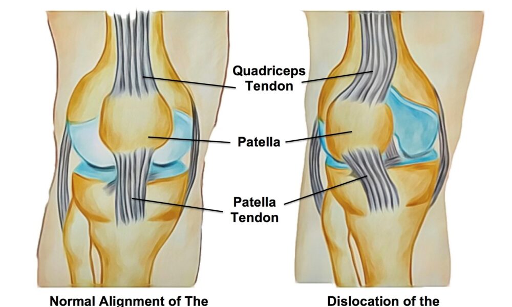 best knee surgeon in chembur