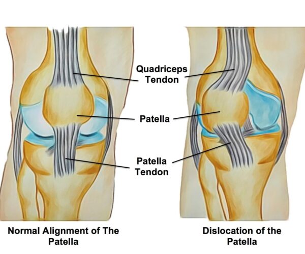 best knee surgeon in chembur