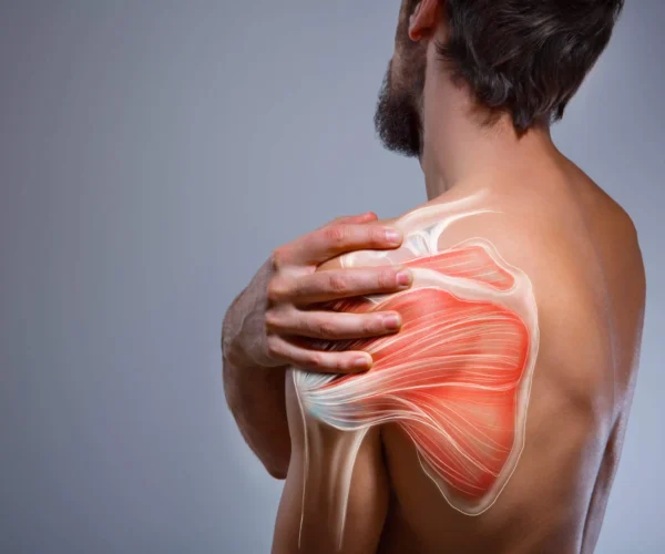 shoulder bursitis treatment in Ghatkopar, Chembur, Kurla, Mumbai