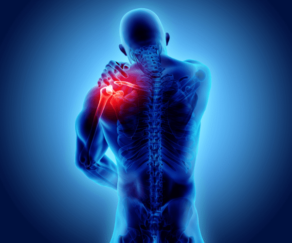Shoulder Arthroscopy surgery
