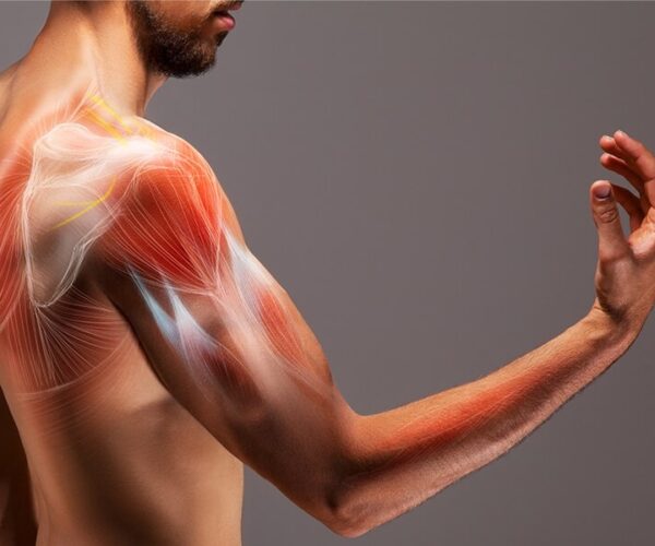 shoulder impingement treatment
